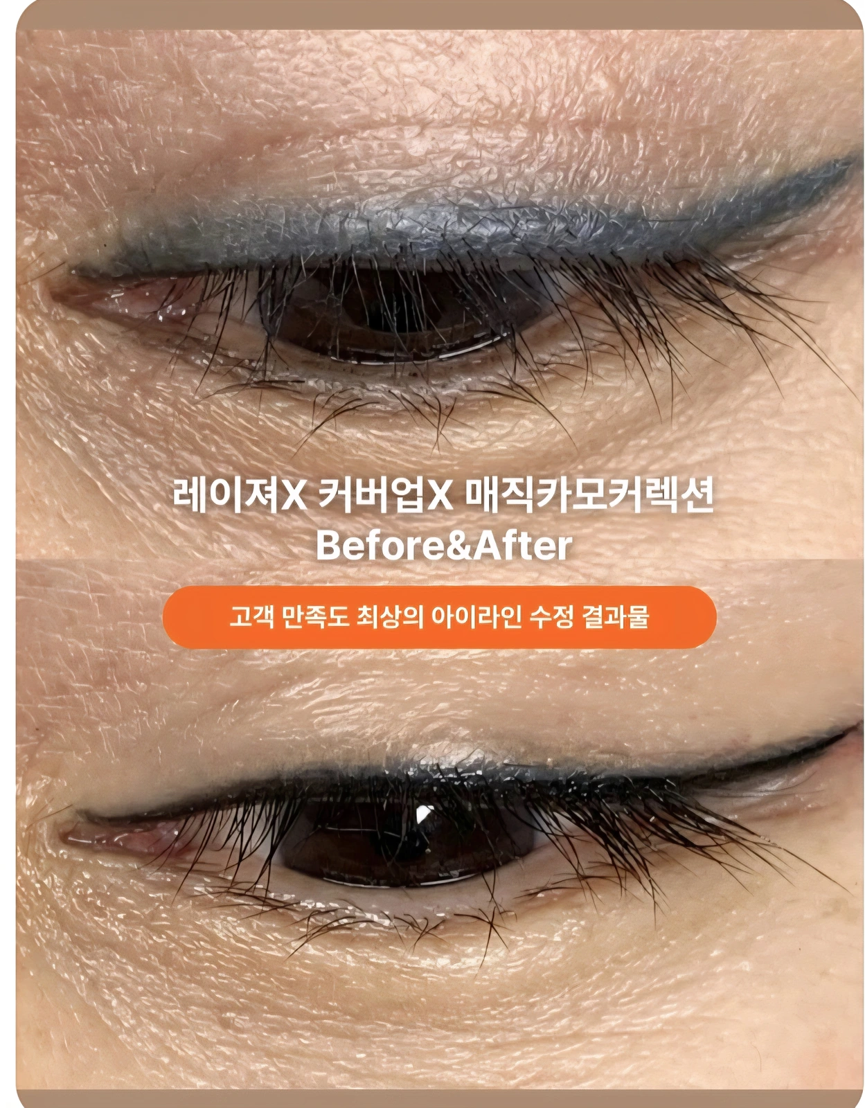 아이라인 수정복원 비교 사례